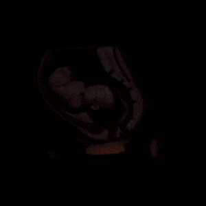 Holograma de ecografía animada, feto en útero