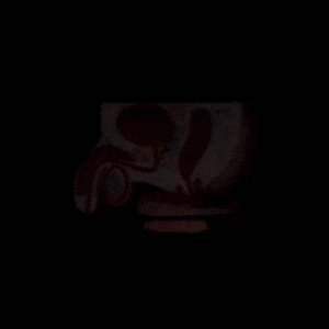 Male_Reproductive_System_cf9d9226f1-ezgif.com-optimize